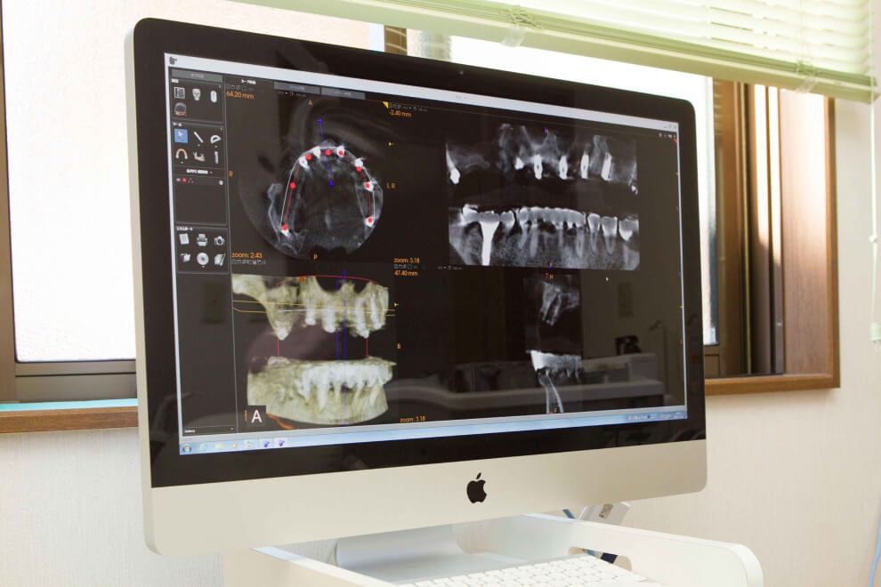大型歯科用CT、デジタルレントゲン